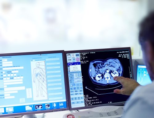 Guida al Risarcimento Danni per Errori da Apparecchiature Mediche Difettose