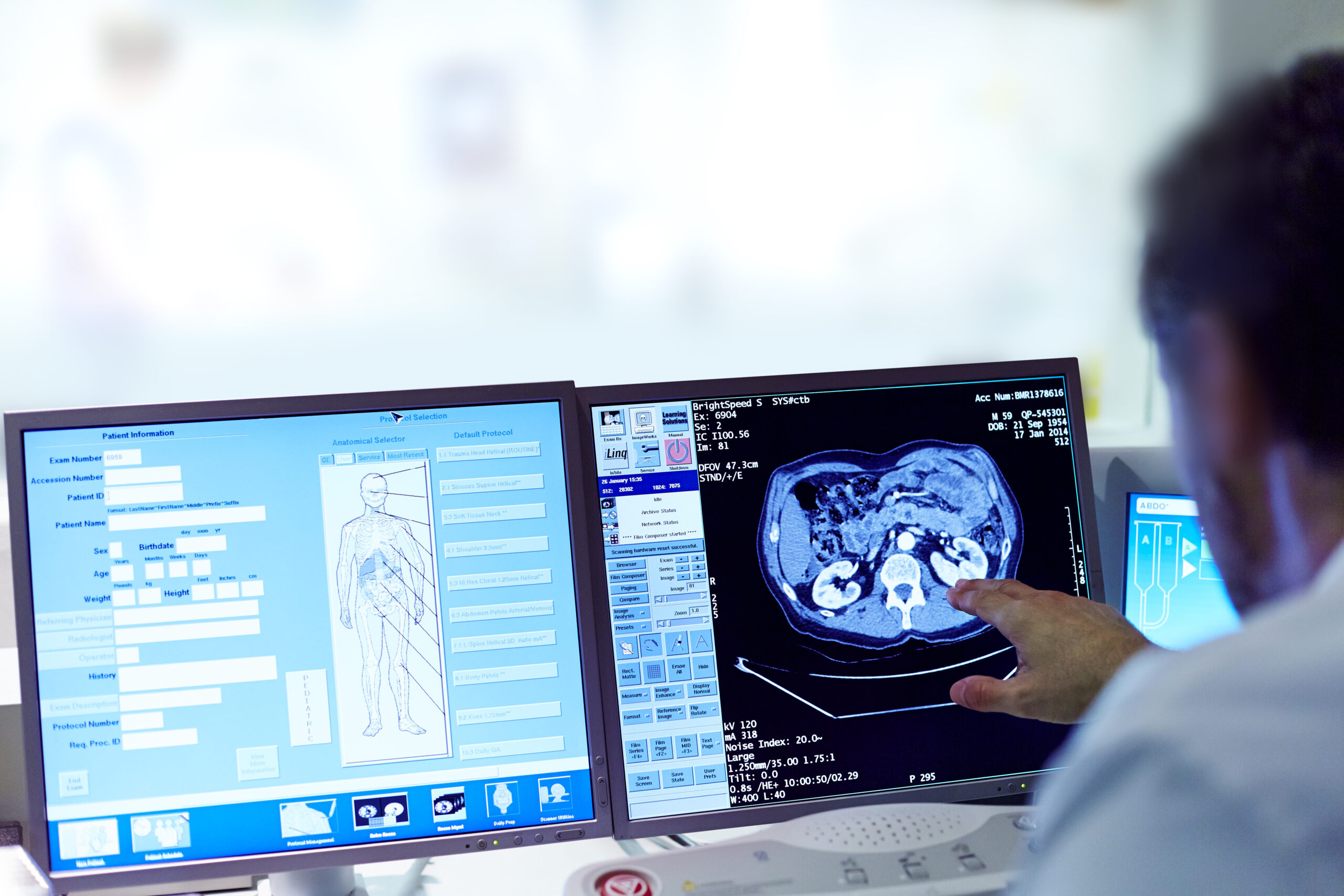 Monitoraggio di apparecchiature mediche in un ospedale di Roma per prevenire errori e danni.