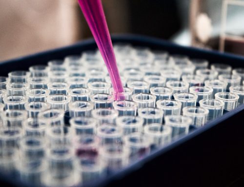 Ritardo Diagnosi Tumore: Come Provare la Negligenza Medica e Ottenere Risarcimento