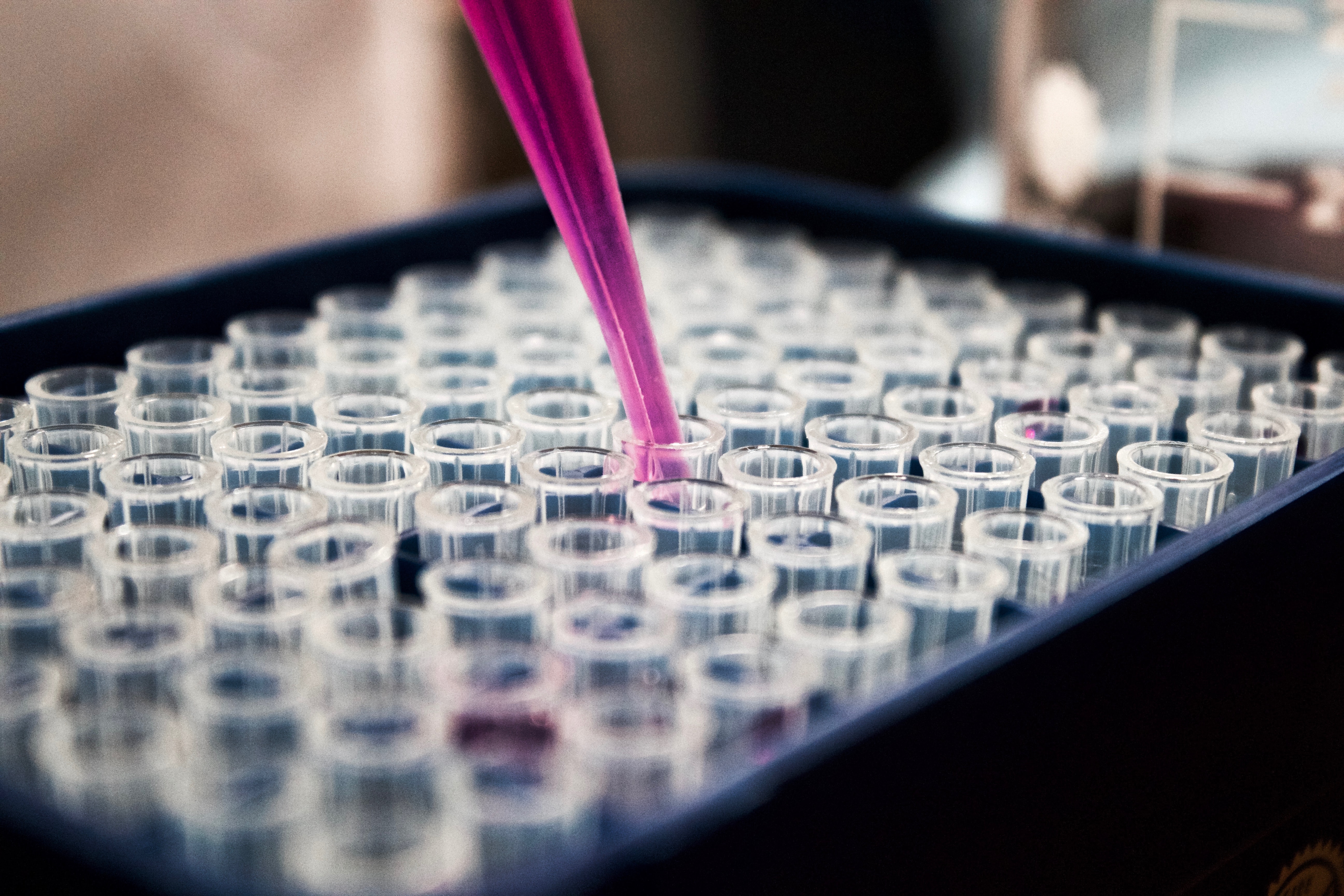Laboratorio di patologia oncologica e diagnosi tumorale - Malasanità per ritardo diagnostico
